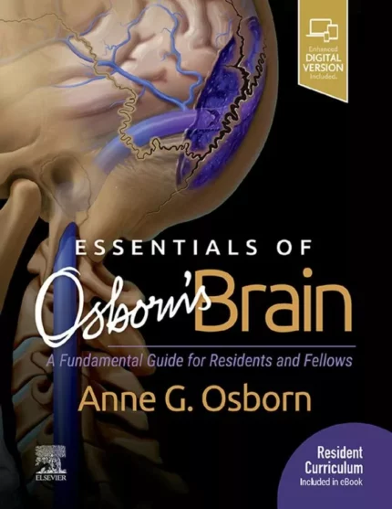 Essentials of Osborn’s Brain – PDF