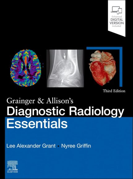 Grainger & Allison's Diagnostic Radiology Essentials (3rd Edition) – eBook PDF